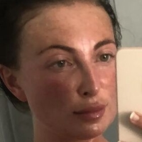 fergsbecomesfergo Nude