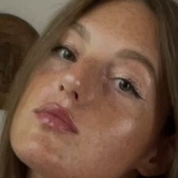frecklus Nude